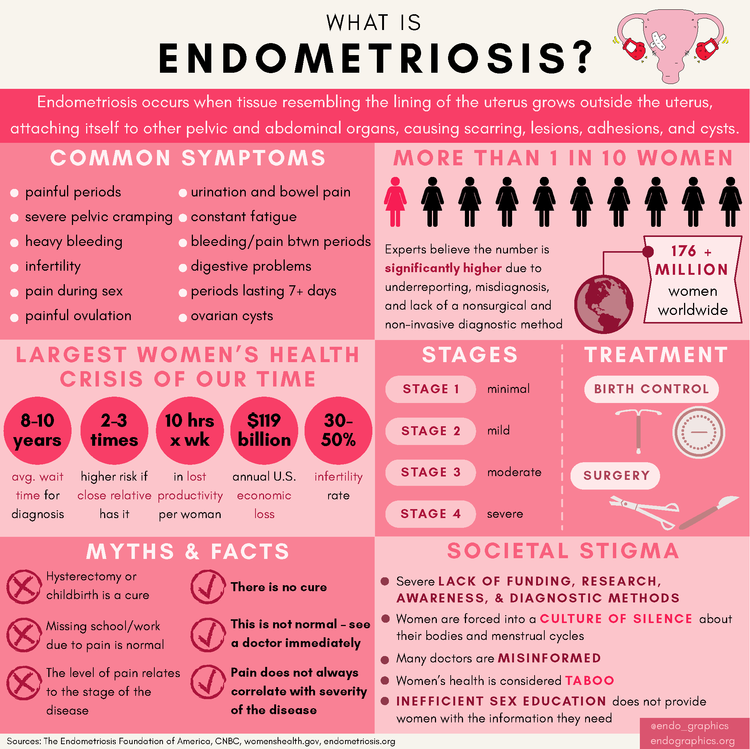 poster about endometriosis